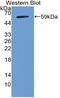 Notch Receptor 3 antibody, LS-C374974, Lifespan Biosciences, Western Blot image 