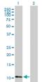 ATP Synthase Inhibitory Factor Subunit 1 antibody, H00093974-B01P, Novus Biologicals, Western Blot image 