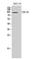 Discs Large MAGUK Scaffold Protein 2 antibody, A04826, Boster Biological Technology, Western Blot image 