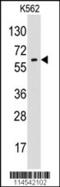 Glypican 6 antibody, 62-268, ProSci, Western Blot image 