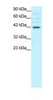 POU Class 3 Homeobox 4 antibody, orb329551, Biorbyt, Western Blot image 