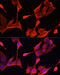 Keratin 1 antibody, 16-521, ProSci, Immunofluorescence image 