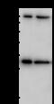Endoglin antibody, 100558-T36, Sino Biological, Western Blot image 