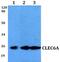 C-Type Lectin Domain Containing 6A antibody, PA5-75724, Invitrogen Antibodies, Western Blot image 