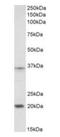 Homeobox A9 antibody, orb20591, Biorbyt, Western Blot image 