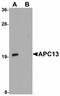 Anaphase Promoting Complex Subunit 13 antibody, orb89875, Biorbyt, Western Blot image 