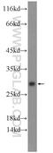 Muscle, intestine and stomach expression 1 antibody, 25140-1-AP, Proteintech Group, Western Blot image 
