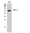 Myocyte Enhancer Factor 2A antibody, STJ94063, St John