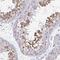Adenosine Deaminase TRNA Specific 3 antibody, PA5-63626, Invitrogen Antibodies, Immunohistochemistry paraffin image 