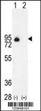 Endoglin antibody, 55-726, ProSci, Western Blot image 