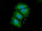 Acyl-CoA Synthetase Family Member 2 antibody, GTX57705, GeneTex, Immunofluorescence image 