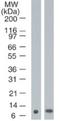 Protein S100-A7 antibody, NBP2-24911, Novus Biologicals, Western Blot image 