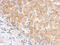 Complement C5 antibody, LS-C186223, Lifespan Biosciences, Immunohistochemistry paraffin image 