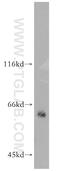 TNF Receptor Associated Factor 6 antibody, 12809-1-AP, Proteintech Group, Western Blot image 
