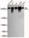 Chromodomain Helicase DNA Binding Protein 3 antibody, STJ99071, St John