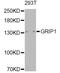 Glutamate Receptor Interacting Protein 1 antibody, A5747, ABclonal Technology, Western Blot image 