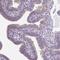Von Willebrand Factor A Domain Containing 3B antibody, PA5-57779, Invitrogen Antibodies, Immunohistochemistry paraffin image 