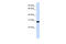 Zinc Finger C2HC-Type Containing 1B antibody, 26-580, ProSci, Enzyme Linked Immunosorbent Assay image 