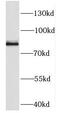 DExD-Box Helicase 50 antibody, FNab02313, FineTest, Western Blot image 