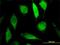 GPAT4 antibody, H00137964-M02, Novus Biologicals, Immunocytochemistry image 
