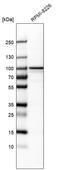 Coiled-coil domain-containing protein 39 antibody, HPA035364, Atlas Antibodies, Western Blot image 