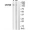 Contactin 6 antibody, A07585-1, Boster Biological Technology, Western Blot image 