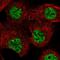 TAR (HIV-1) RNA Binding Protein 1 antibody, PA5-55130, Invitrogen Antibodies, Immunofluorescence image 