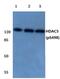 Histone Deacetylase 5 antibody, PA5-36647, Invitrogen Antibodies, Western Blot image 