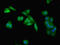 Inositol Polyphosphate-5-Phosphatase A antibody, LS-C318122, Lifespan Biosciences, Immunofluorescence image 