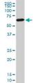 Forkhead Box C2 antibody, H00002303-M08, Novus Biologicals, Western Blot image 