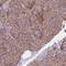 Adenylate Kinase 3 antibody, HPA063324, Atlas Antibodies, Immunohistochemistry paraffin image 