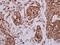 Anterior Gradient 3, Protein Disulphide Isomerase Family Member antibody, LS-C186036, Lifespan Biosciences, Immunohistochemistry paraffin image 