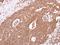 Adrenoceptor Beta 2 antibody, GTX100040, GeneTex, Immunohistochemistry paraffin image 