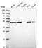Integrin Linked Kinase antibody, HPA048437, Atlas Antibodies, Western Blot image 