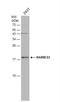 Phospholipase A And Acyltransferase 4 antibody, NBP2-20080, Novus Biologicals, Western Blot image 