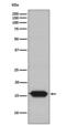 NADH dehydrogenase [ubiquinone] 1 alpha subcomplex subunit 13 antibody, M05981-1, Boster Biological Technology, Western Blot image 