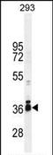 Stimulated by retinoic acid gene 8 protein antibody, PA5-35047, Invitrogen Antibodies, Western Blot image 