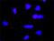 Discs Large MAGUK Scaffold Protein 1 antibody, H00001739-M01, Novus Biologicals, Proximity Ligation Assay image 