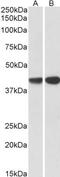 CAPG antibody, PA5-37847, Invitrogen Antibodies, Western Blot image 