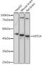 Keratin 14 antibody, GTX66326, GeneTex, Western Blot image 