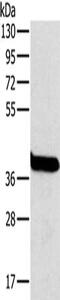 Ornithine Carbamoyltransferase antibody, CSB-PA189809, Cusabio, Western Blot image 