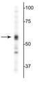 Gamma-Aminobutyric Acid Type A Receptor Alpha5 Subunit antibody, NB300-195, Novus Biologicals, Western Blot image 