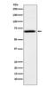ATP Binding Cassette Subfamily D Member 3 antibody, M02370, Boster Biological Technology, Western Blot image 