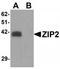 Zinc transporter ZIP2 antibody, TA319907, Origene, Western Blot image 