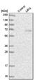 Lipase G, Endothelial Type antibody, HPA016966, Atlas Antibodies, Western Blot image 