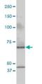 Cleavage Stimulation Factor Subunit 2 antibody, H00001478-M01, Novus Biologicals, Western Blot image 