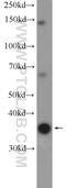 Zinc Finger C2HC-Type Containing 1C antibody, 20520-1-AP, Proteintech Group, Western Blot image 