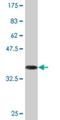 Tweety Family Member 1 antibody, H00057348-M02, Novus Biologicals, Western Blot image 