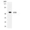 SH2 Domain Containing Adaptor Protein B antibody, LS-C200667, Lifespan Biosciences, Western Blot image 