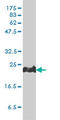 Peroxiredoxin 1 antibody, LS-C197839, Lifespan Biosciences, Western Blot image 